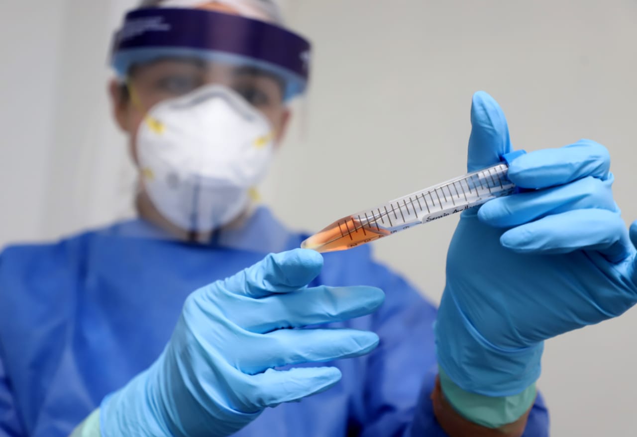  Laboratorio Estatal de Salud Pública, certeza en resultados de muestras COVID-19