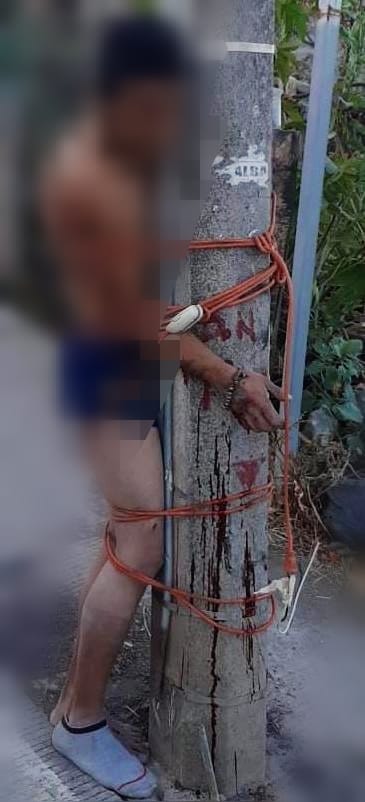 Dejan a un presunto ladrón amarrado a un poste y con una lesión de bala en las manos
