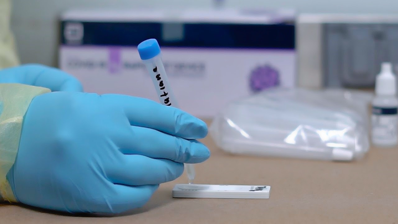  Ha realizado SSM más de 24 mil pruebas de antígeno en los Módulos de Enfermedades Respiratorias
