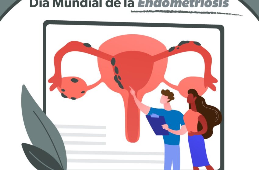  SSM cuenta con clínica especializada para atender la endometriosis